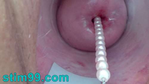 Женская матка крупным планом